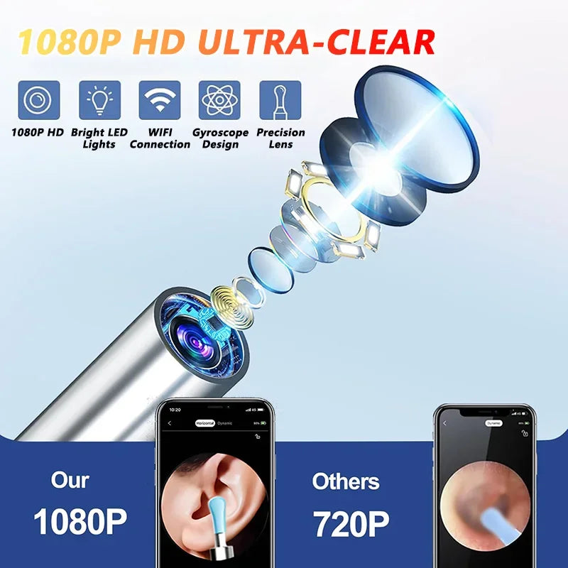 South Moon Visual Ear Wax Cleaner With Camera Endoscope