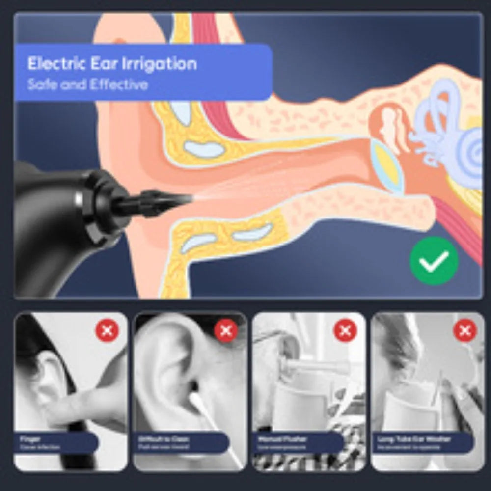 Hign-concerned Electric Ear Cleaner Kit With 4 Modes